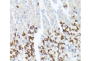 Immunohistochemistry of paraffin-embedded Mouse stomach using GPM6A Polyclonal Antibody at dilution of 1:100 (40x lens).