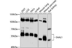 anti-serum Amyloid A-Like 1 (SAAL1) (AA 175-474) antibody