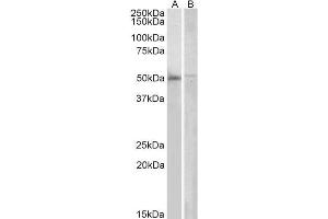 ABIN184642 (2µg/ml) staining of Human Bone Marrow (A) and PBL (B) lysates (35µg protein in RIPA buffer). (DOK3 anticorps  (C-Term))