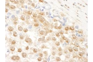 Immunohistochemistry (IHC) image for anti-N(alpha)-Acetyltransferase 15, NatA Auxiliary Subunit (NAA15) (AA 816-866) antibody (ABIN7448680) (NAA15 anticorps  (AA 816-866))