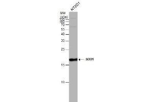 WB Image SOD1 antibody detects SOD1 protein by western blot analysis. (SOD1 anticorps)