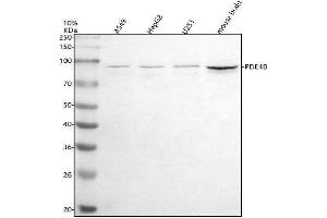 Western blot analysis of PDE4B using anti-PDE4B antibody (ABIN7599537).