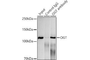 Immunoprecipitation analysis of 300 μg extracts of HeLa cells using 3 μg OGT antibody (ABIN7269074).