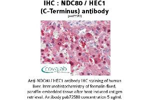 Image no. 2 for anti-NDC80 Kinetochore Complex Component Homolog (NDC80) (C-Term) antibody (ABIN1737233) (NDC80 anticorps  (C-Term))