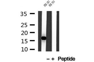 Western blot analysis of extracts of HEK-293 cells, using IFT20 antibody. (IFT20 anticorps)