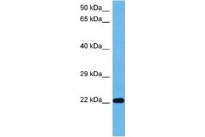 Host:  Mouse  Target Name:  TNNI3  Sample Tissue:  Mouse Pancreas  Antibody Dilution:  1ug/ml (TNNI3 anticorps  (Middle Region))
