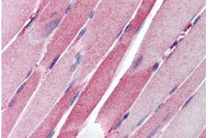 anti-CASP8 Associated Protein 2 (CASP8AP2) (C-Term) antibody