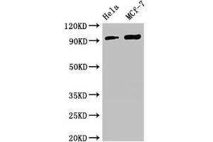 Western Blot Positive WB detected in: Hela whole cell lysate, MCF-7 whole cell lysate All lanes: TTC27 antibody at 2. (TTC27 anticorps  (AA 590-817))