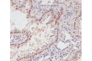 Immunohistochemistry of paraffin-embedded Rat lung using Phospho-PEA15(S104) Polyclonal Antibody at dilution of 1:100 (40x lens).