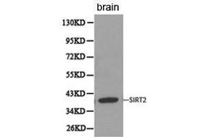 Western Blotting (WB) image for anti-Sirtuin 2 (SIRT2) antibody (ABIN1874785) (SIRT2 anticorps)