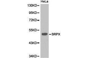 Western Blotting (WB) image for anti-Sushi-Repeat Containing Protein, X-Linked (SRPX) antibody (ABIN1874945) (SRPX anticorps)