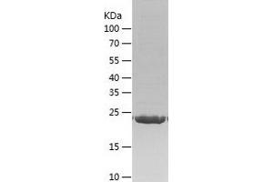 Western Blotting (WB) image for RAB27B, Member RAS Oncogene Family (RAB27B) (AA 1-218) protein (His tag) (ABIN7124746)