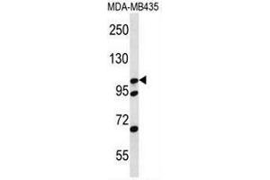 CTNND2 Antibody (C-term) western blot analysis in MDA-MB435 cell line lysates (35µg/lane). (CTNND2 anticorps  (C-Term))