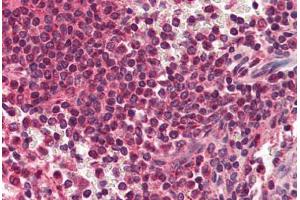 Human Spleen (formalin-fixed, paraffin-embedded) stained with RYBP antibody ABIN214470 at 2. (RYBP anticorps  (AA 215-228))