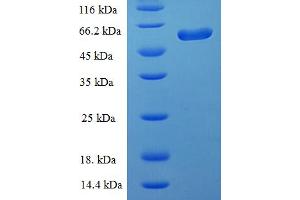 SDS-PAGE (SDS) image for Chitinase 3-Like 2 (CHI3L2) (AA 27-390) protein (His-SUMO Tag) (ABIN5711239)