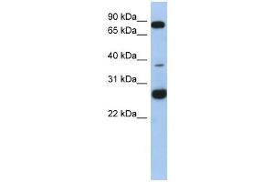 C1ORF110 antibody used at 1 ug/ml to detect target protein. (C1ORF110 anticorps  (N-Term))