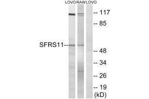 Western blot analysis of extracts from LOVO cells and RAW264. (SRSF11 anticorps)