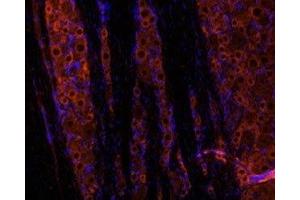 Expression of GDNF in rat dorsal root ganglion (DRG).