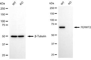 Western blotting analysis using FERMT2 antibody (ABIN7798593). (FERMT2 anticorps)