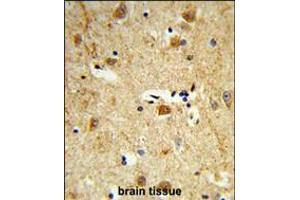Formalin-fixed and paraffin-embedded human brain tissue reacted with DOLK Antibody , which was peroxidase-conjugated to the secondary antibody, followed by DAB staining.