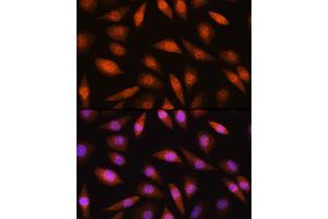 Immunofluorescence analysis of L929 cells using LIMK2 Rabbit pAb (ABIN6128187, ABIN6143230, ABIN6143231 and ABIN6221057) at dilution of 1:100 (40x lens).