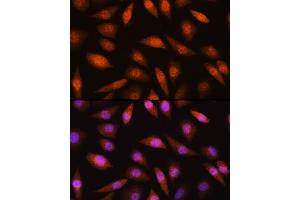 Immunofluorescence analysis of L929 cells using LIMK2 Rabbit pAb (ABIN6128187, ABIN6143230, ABIN6143231 and ABIN6221057) at dilution of 1:100 (40x lens). (LIMK2 anticorps  (AA 1-240))