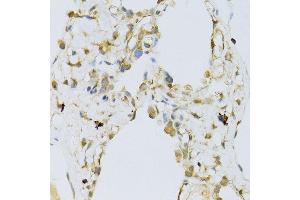 Immunohistochemistry of paraffin-embedded human lung using RPL13 antibody (ABIN1682571, ABIN5664631, ABIN5664633 and ABIN6220492) at dilution of 1:100 (40x lens). (RPL13 anticorps  (AA 1-211))