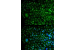 Immunofluorescence analysis of U20S cell using ANG antibody. (ANG anticorps)