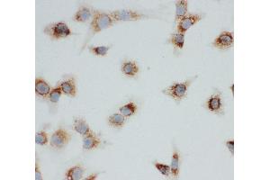 Anti-VDAC/Porin antibody, ICC ICC: NIH3T3 Cell