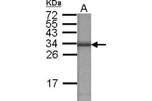 Image no. 2 for anti-ATPase, H+ Transporting, Lysosomal 31kDa, V1 Subunit E2 (ATP6V1E2) antibody (ABIN1502161) (ATP6V1E2 anticorps)