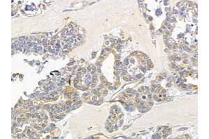 anti-Intraflagellar Transport 122 (IFT122) (N-Term) antibody