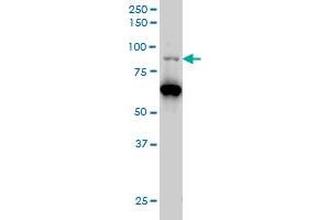 PCAF monoclonal antibody (M06), clone 5E5 Western Blot analysis of PCAF expression in Hela S3 NE .