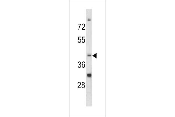 CCRN4L anticorps  (C-Term)