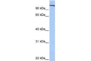 WB Suggested Anti-FES Antibody Titration: 0. (FES anticorps  (N-Term))