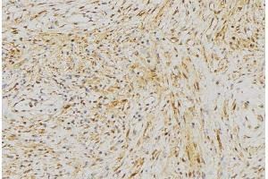 ABIN6272968 at 1/100 staining Mouse muscle tissue by IHC-P.