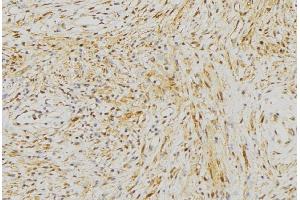 ABIN6272968 at 1/100 staining Mouse muscle tissue by IHC-P. (NLRX1 anticorps  (Internal Region))