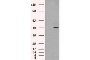 Image no. 1 for anti-Tubulin, beta 3 (TUBB3) (AA 1-150) antibody (ABIN1490580) (TUBB3 anticorps  (AA 1-150))