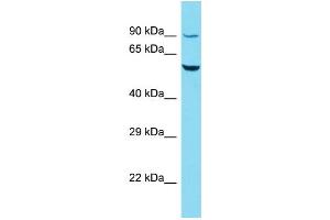 Host: Rabbit Target Name: R3HCC1L Sample Type: HepG2 Whole Cell lysates Antibody Dilution: 1. (GIDRP88 anticorps  (C-Term))