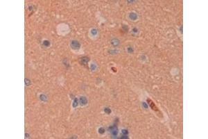 IHC-P analysis of Human Tissue, with DAB staining. (Peroxiredoxin 4 anticorps  (AA 6-249))