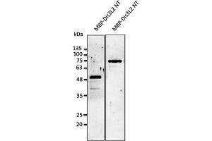 Western Blotting (WB) image for anti-DIS3-Like Exonuclease 2 (DIS3L2) (N-Term) antibody (ABIN7272981) (DIS3L2 anticorps  (N-Term))