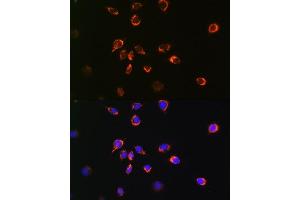 Immunofluorescence analysis of L929 cells using Bax antibody (ABIN7265858).