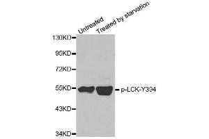 Western blot analysis of extracts from JK cells, using phospho-LCK-Y394 polyclonal antibody (ABIN2987539). (LCK anticorps  (pTyr394))