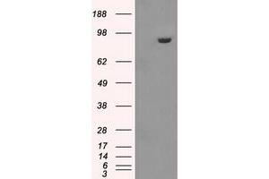 Image no. 1 for anti-Glucan (1,4-alpha-), Branching Enzyme 1 (GBE1) antibody (ABIN1498396)