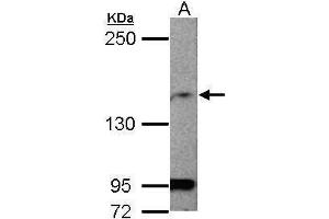 WB Image Sample (50 ug of whole cell lysate) A: mouse brain 5% SDS PAGE antibody diluted at 1:1000