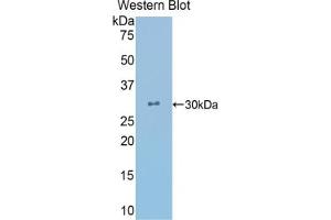 Detection of Recombinant CRYl1, Human using Polyclonal Antibody to Crystallin Lambda 1 (CRYl1)