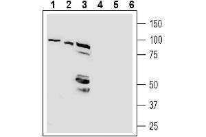 Western blot analysis of human Jurkat T-cell leukemia cell line lysates (lanes 1 and 4), human HepG2 hepatocellular carcinoma cell line lysate (lanes 2 and 5) and human Colo-205 colon carcinoma cell line lysates (lanes 3 and 6):1-3.