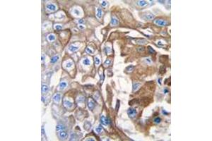 Image no. 2 for anti-GTPase NRas (NRAS) (C-Term) antibody (ABIN360039) (GTPase NRas anticorps  (C-Term))