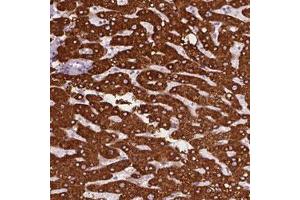 Immunohistochemical staining (Formalin-fixed paraffin-embedded sections) of human liver with CES1 polyclonal antibody  shows strong cytoplasmic positivity in hepatocytes.