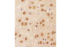 Immunohistochemical analysis of paraffin-embedded M. (SIRT1 anticorps  (C-Term))