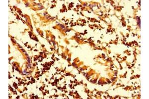 Immunohistochemistry of paraffin-embedded human appendix tissue using ABIN7155576 at dilution of 1:100 (HLA-DMA anticorps  (AA 27-233))